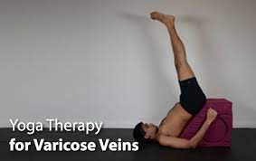 Check spelling or type a new query. Yoga Therapy For Varicose Veins Asana International Yoga Journal