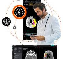 Solutions d'analyse d'imagerie d'urgence – Olea Medical
