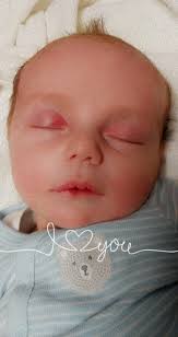 Newborn baby not gaining weight