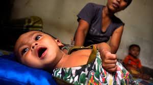 The Toxic Toll of Indonesia's Gold Mines