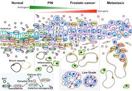 Although it is the most commonly diagnosed cancer in american women, breast cancer can impact people of all genders. Estrogens And Prostate Cancer Etiology Mediators Prevention And Management Endocrinology And Metabolism Clinics