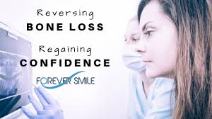 It is important to remove plaque and calculus to restore periodontal health. Reversing Your Bone Loss Regaining Your Confidence