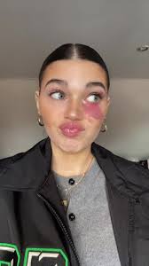 #braces #bracesoff #transition #transformation #fypage #fyp