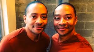 Meet Chicago Med's Conjoined Twins In Real Life: Jason & Victor Turner
