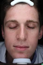 A PILOT STUDY TO ASSESS THE EFFICACY AND TOLERABILITY OF TWO NEW  PROPRIETARY, PURE HYPOCHLOROUS ACID-BASED (HOCL) TREATMENTS FO