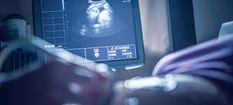Antenatal Hydronephrosis Benign Finding Or Congenital Anomaly Of The Kidney Urinary Tract Nyu Langone News
