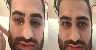 Doctor's mouth wired shut for a month after thug broke his jaw while  shouting homophobic slur