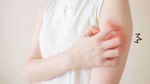 Hal ini sebenarnya jarang terjadi. Mudah Dicoba Ini 5 Cara Mengatasi Kulit Gatal Karena Diabetes Orami