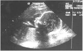 We did not find results for: Affordable Laparoscopic Pelvic Ultrasound Procedure In India Low Cost Pelvic Ultrasound Procedure