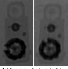 Codman har en ny ventil som heter certas vilken inte ändrar inställning efter mr. Programming Jammed Codman Hakim Programmable Valves Study Of An Explanted Valve And Successful Programming In A Patient Semantic Scholar