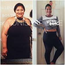 before and after with gastric sleeve