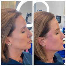 Vitality Wellness- Fort Worth (@vitality.wellness.tx) • Instagram photos  and videos