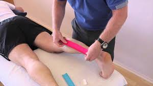 Image result for Taping for Soleus and Achilles