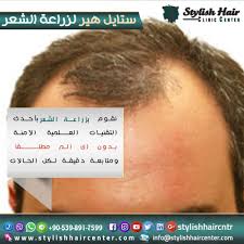 نقدم لكم عروض متنوعة لعلاج مشاكل الشعر المختلفة ايا ما كان السبب تألق بمظهر جذاب وشعر كثيف مع المتنوعة من مركز ستايل هير لزراعة الشع Stylish Hair Clinic Hair