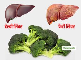 fatty liver disease diet 5 foods to helps reduce fat in the