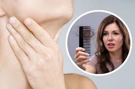 1.) thinning hair or hair loss The Link Between Thyroid Disease And Hair Loss Dhi Mexico