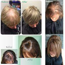Unlike a wig, it blends seamlessly with your own natural hair. Women Hair Topper Hairpiece Human Crown Hair Wigs Toupees For Thinning Loss Hair Ebay