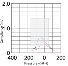 Image result for Tympanometry
