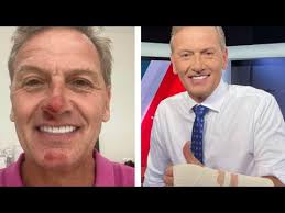 Channel Seven's Mark Soderstrom's Shocking Bike Crash!