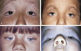 Image result for Blepharis transvaalensis