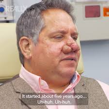 The AMAZING reshaping of Tony's Nose 🤩