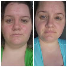 Dream Luxe Sleeping Mask