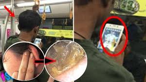 Tinnitus mungkin merupakan satu satunya gejala penyakit yang ada pada seseorang yang. Sakit Telinga Tanda Ada Kerabat Kita Meninggal Dan Daun Dia Di Akhirat Gugur Dan Terkena Daun