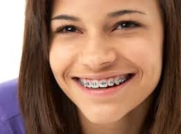 Clareo orthodontics Hull