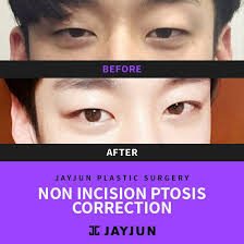 Pin On Before And After Photos