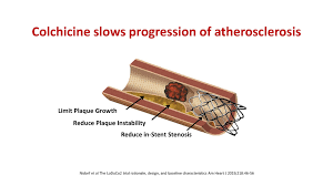 Image result for Colchicine