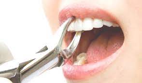 Maybe you would like to learn more about one of these? Arti Mimpi Mencabut Gigi Menurut Primbon Jawa Dan Psikolog