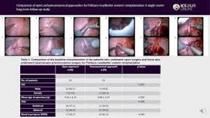 Politano leadbetter steps 1) incision through dome of bladder 00:12 2) identify location of politano leadbetter preimplantation, an intravesical supra trigonal technique avoids crossing of ureteric. Ics 2020 Abstract 386 Open Versus Pneumovesical Politano Leadbetter Ureteric Reimplantation Approaches A Single Center Long Term Follow Up Study