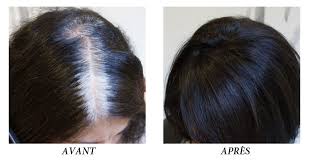 Bye bye les cheveux blancs (et les produits toxiques). Coloration Vegetale 100 Naturelle Notre Specialite France In Paris Coiffeur Visagiste Coloriste Meilleur Ouvrier De France A Paris 17