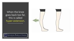 Image result for Knee Bulge Sign