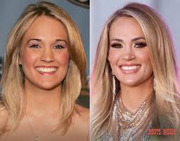 Carrie Underwood when she started vs now. Always a Country queen.