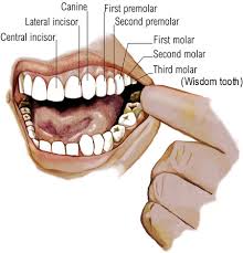 Image result for Tooth Extraction