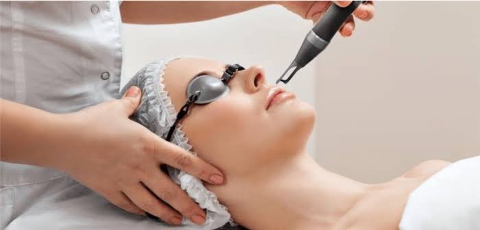 Best Helios Pico Laser for Pigmentation in Islamabad