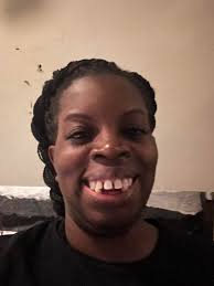 Well today I got the last 17 teeth pulled and had a mandibular tori removed  at the same time. I was in at 10:30 am and out by 1:35pm. I am still