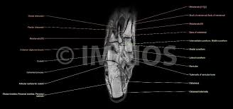 Feet and ankles ankle muscle anatomy of foot muscles of foot muscles foot foot muscles anatomy muscle composite video showing multiple mri images including: Anatomy Of The Foot And Ankle Mri