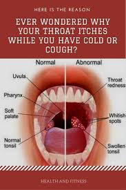 Ever Wondered Why Your Throat Itches While You Have Cold Or Cough Here Is The Reason Throat Remedies Health Goals Swollen Tonsils