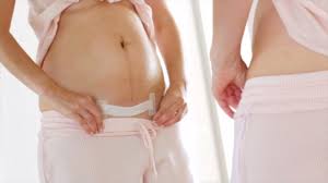 C Section Infections Signs Prevention And Treatment Parents