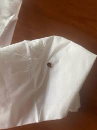 害虫駆除を頑張った話。トコジラミという生き物を知っていますか？｜TechRacho by BPS株式会社