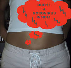 Information on tab 7a visualizes cases by date of infection. Le Blog D Albert Amgar Epilogue Provisoire Des Foyers De Toxi Infections Alimentaires Collectives Suspectes D Etre Lies A Des Coquillages Crus En France Norovirus Inside