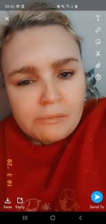 How to manage and treat eczema?