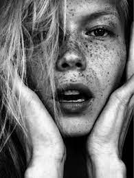 Pin On Freckles