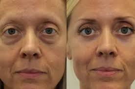 Boulder, Broomfield, Weld home sales: Oct. 12, 2014