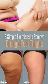 Pin By Emily Anne On Detox Drinks Watermelon Easy Workouts Tighten Stomach Skin Tightening Stomach