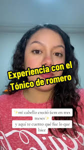 Qué Pasa Si Le Echo Agua De Romero A Mi Bebé De 6 Meses En El Cabello