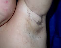A Guide To The World S Strangest And Rarest Diseases