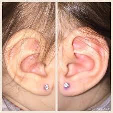 Uneven Ear Piercing Babycenter